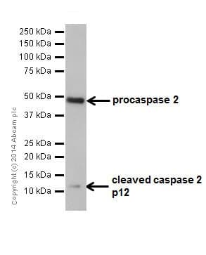 Caspase 2l Antibody Epr16790 Ab179519  Western Blot Img14311