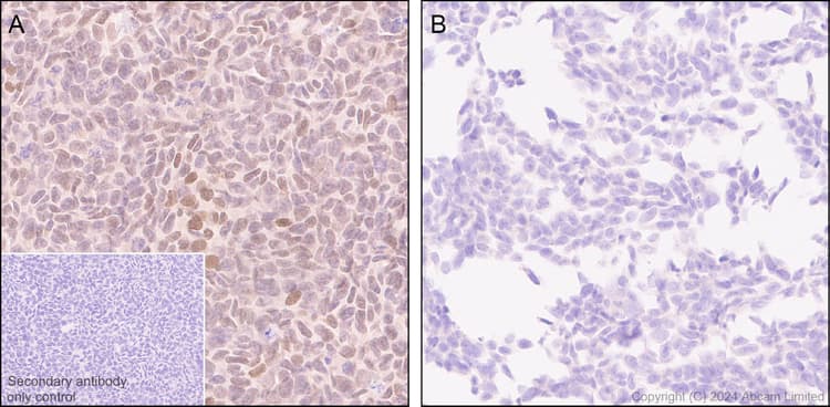 Anti-TBX3 antibody [EPR28578-38](ab322199)