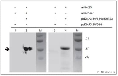 Anti-Phosphoserine antibody(AB9332)
