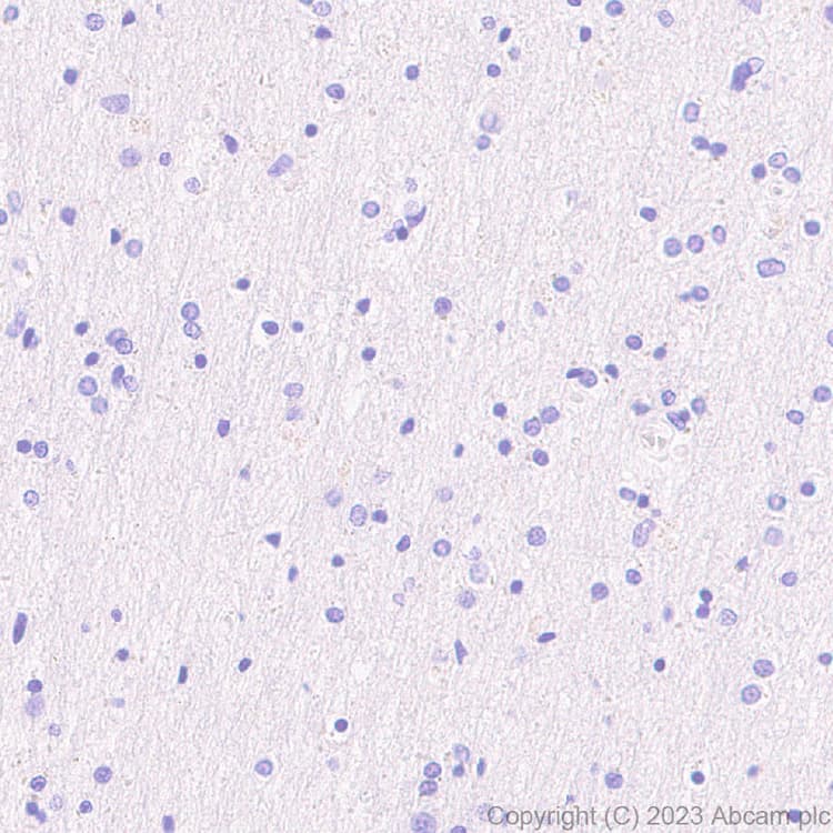 Anti-Neutrophil Elastase antibody [EPR28386-66](AB310335)