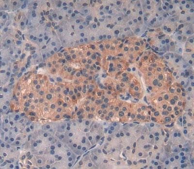 Kallikrein 8 Klk8 Antibody Ab232839  Immunohistochemistry Formalin Pfa Fixed Paraffin Embedded Sections Img20354