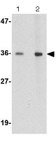 Anti-HAPLN2 antibody(AB124504)