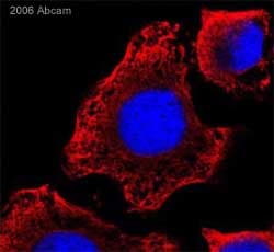 Alpha Tubulin Antibody B 5 1 2 Microtubule Marker Ab11304  Immunocytochemistry Img112781
