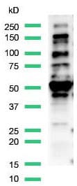 Anti-FOXP1 antibody [SP133] - C-terminal(AB227649)