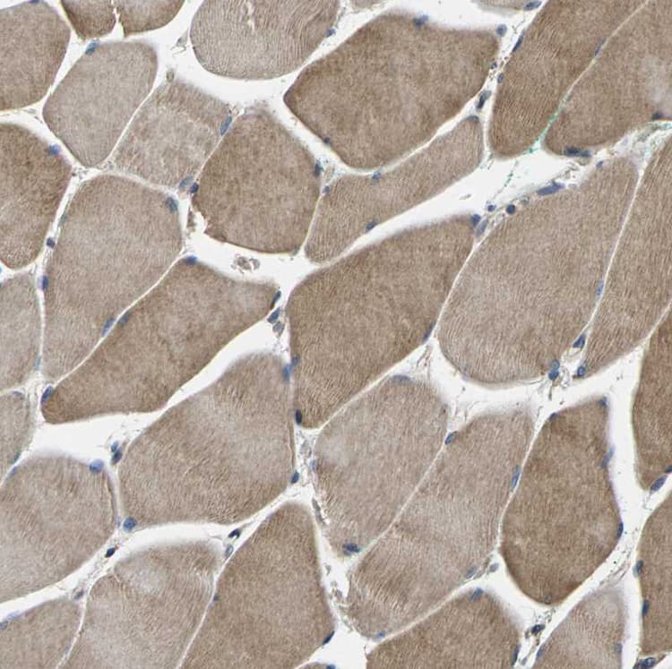 Plce1 Antibody Ab121476  Immunohistochemistry Formalin Pfa Fixed Paraffin Embedded Sections Img123359