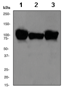 Anti-Sarcomeric Alpha Actinin antibody [EP2529Y](AB68167)