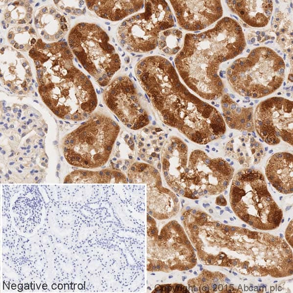 Hrp Gnai2 Antibody Epr9469 Ab205782  Immunohistochemistry Formalin Pfa Fixed Paraffin Embedded Sections Img9310