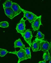 Anti-beta Catenin antibody(AB6302)