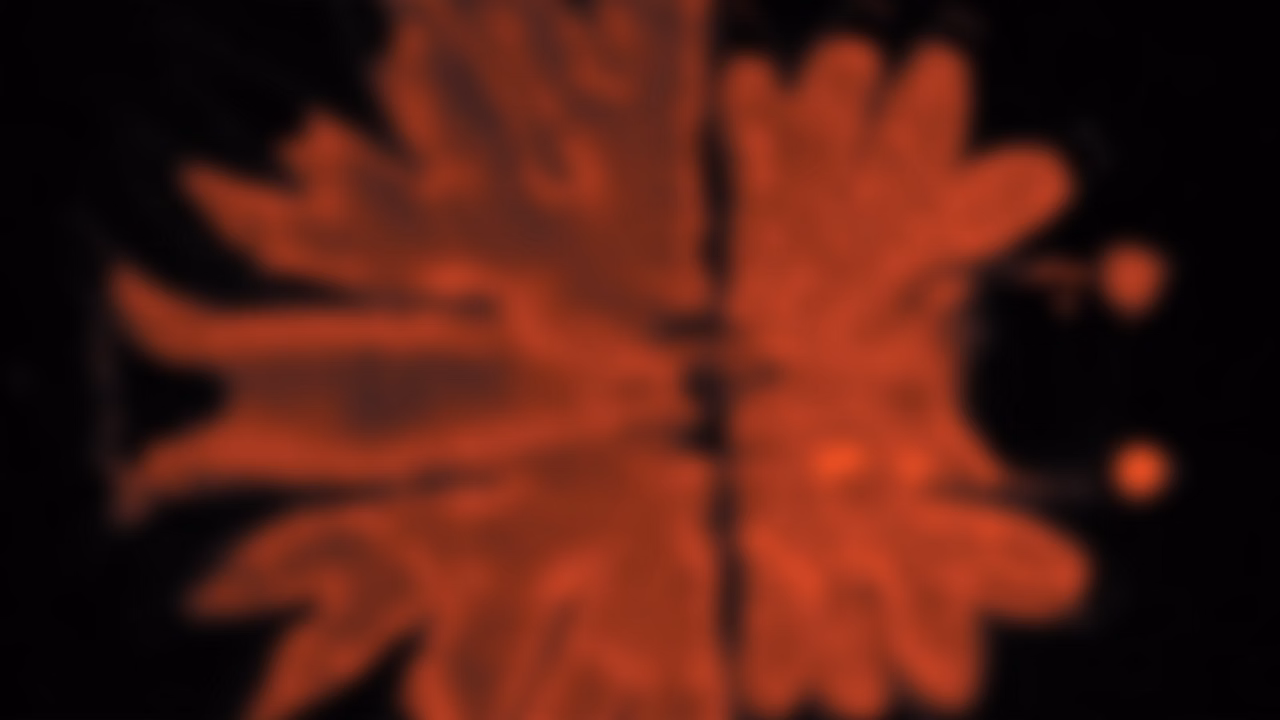 Leica DM1000 2000 3000 Micrasterias Fluorescence Blur Kid21766177