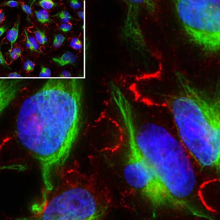 Aurora B Antibody 6g2 Ab315206  Immunocytochemistry Immunofluorescence Img423293