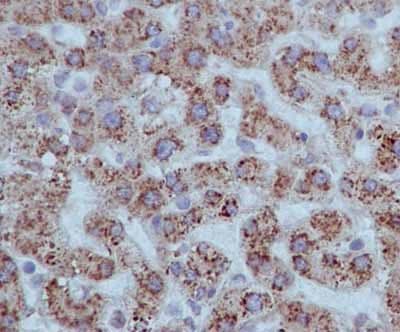 Ramp4 2 Antibody Epr14338 Ab184571  Immunohistochemistry Formalin Pfa Fixed Paraffin Embedded Sections Img111648