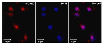 Anti-DNA/RNA Damage antibody [15A3](AB62623)