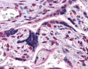 Gbx2 Antibody Ab109726  Immunohistochemistry Formalin Pfa Fixed Paraffin Embedded Sections Img25117