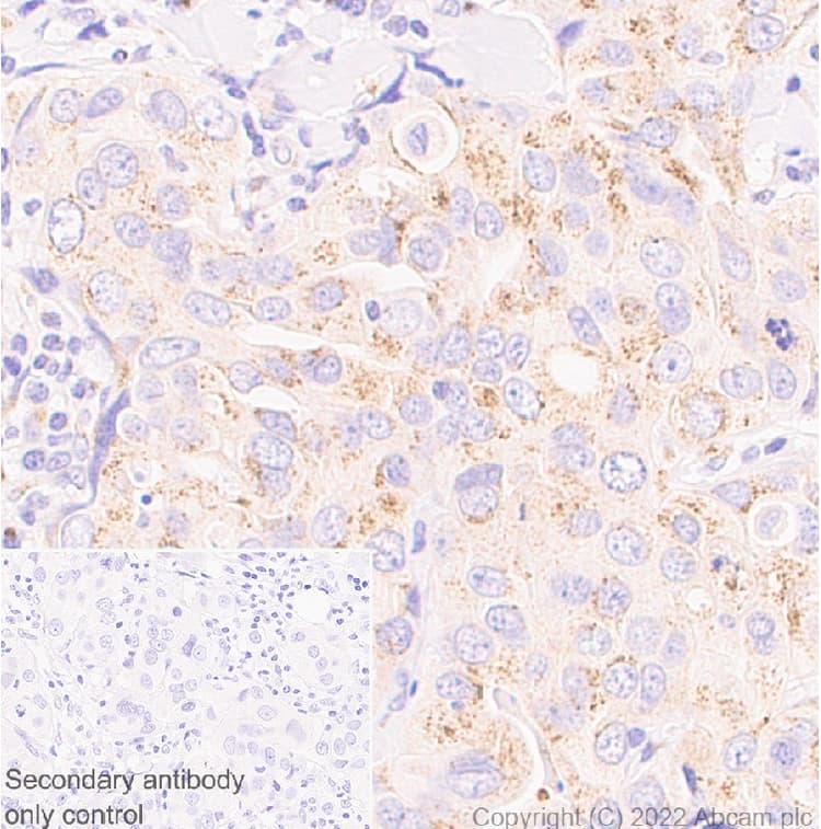 Anti-GM130 antibody [EP892Y] - Chicken IgY (Chimeric)(AB302489)
