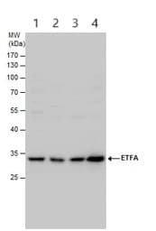 Etfa Antibody Ab153722  Western Blot Img449736
