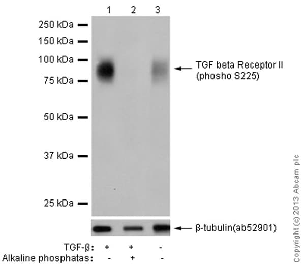 Anti-TGF beta Receptor II (phospho S225) antibody [EPR12198](AB183037)