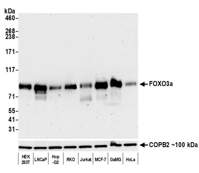 Foxo3a Antibody Blr140h Bsa Free Ab314087  Western Blot Img420585