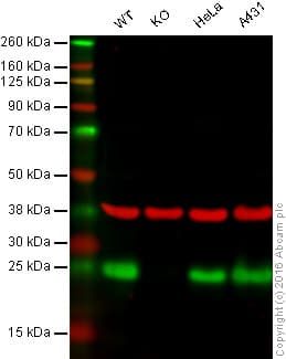 Anti-HPRT antibody [EPR5299](AB109021)
