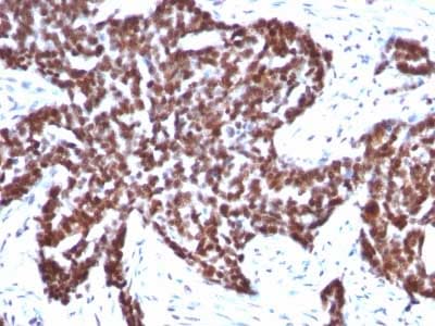 Cyclin B1 Antibody Ccnb1 1098 Ab212977  Immunohistochemistry Formalin Pfa Fixed Paraffin Embedded Sections Img131290