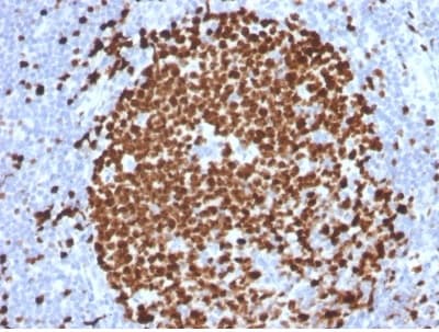 Anti-Ki67 antibody [MKI67/2465](AB238020)