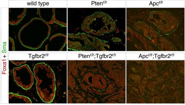 Anti-alpha smooth muscle Actin (acetyl E3) + ACTG2 (acetyl E3) antibody [E184](AB32575)