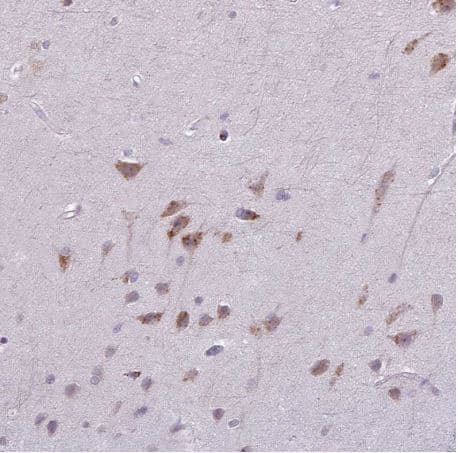 Map7d2 Antibody Ab151140  Immunohistochemistry Formalin Pfa Fixed Paraffin Embedded Sections Img87408