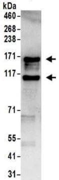 Anti-ADAR1 antibody(AB168809)
