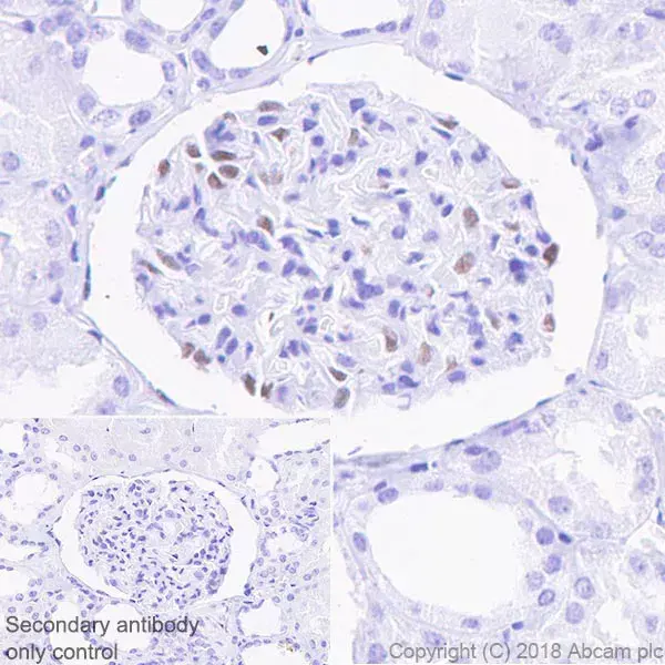 Anti-Wilms Tumor Protein antibody [CAN-R9(IHC)-56-2](AB89901)