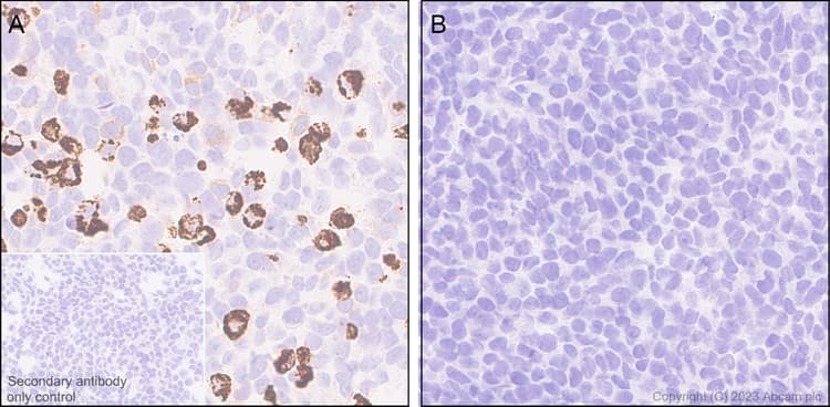 Anti-VSV-G tag antibody [EPR28362-204](AB309106)
