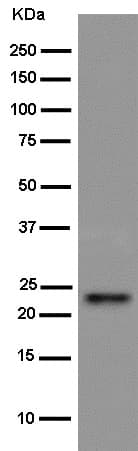 Anti-Bok antibody [EPR15331](AB186745)