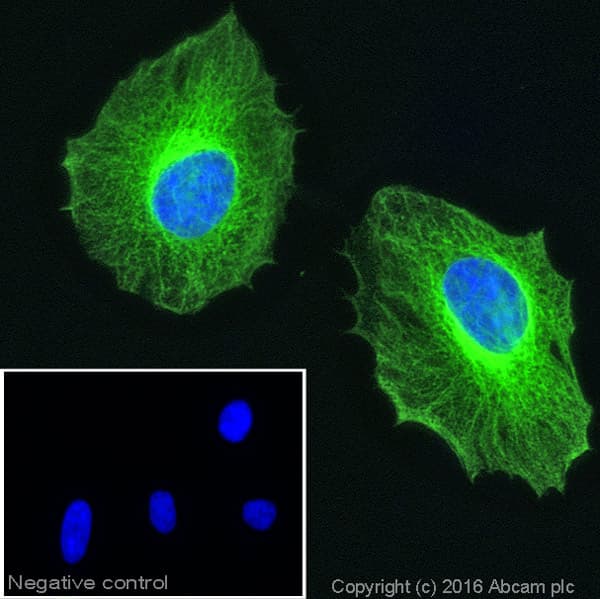 Anti-beta Tubulin antibody - Loading Control(AB6046)