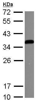 Anti-IGFBP3 antibody(AB272857)
