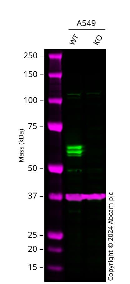 Anti-IRF5 antibody [EPR17067](AB181553)