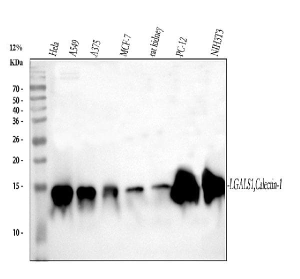 Galectin 1 Antibody Ab112525  Western Blot Img431297