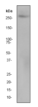 Rna Polymerase Ii Rpb1 Antibody Epr1509y Chip Grade Ab76123  Western Blot Img30839