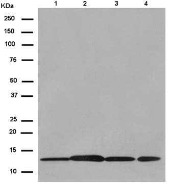 Anti-Prostaglandin E Synthase/MPGES-1 antibody [EPR13765](AB180589)