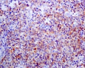 Anti-PD1 antibody [EPR4877(2)] - BSA and Azide free(AB186928)