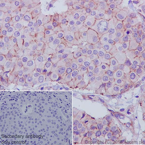 Anti-ZO1 tight junction protein antibody [EPR19945-296](AB221547)
