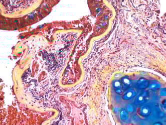 Movat Pentachrome Stain Kit (Modified Russell-Movat)(AB245884)