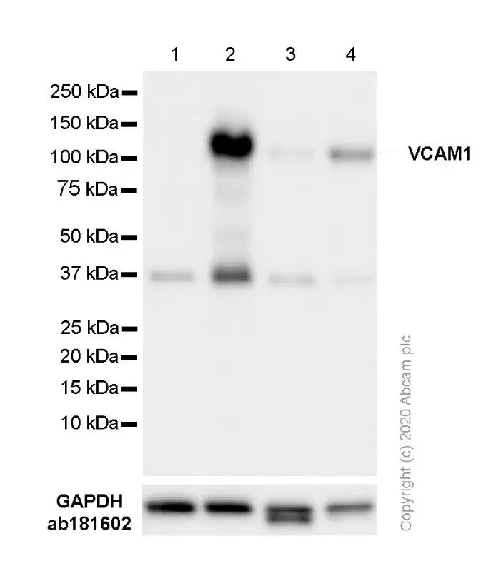 Anti-VCAM1 antibody [EPR5047](AB134047)
