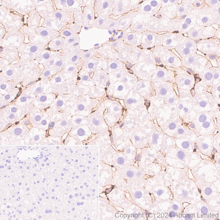 Alkaline Phosphatase Antibody Epr20428 147 Bsa And Azide Free Capture Ab252581  Immunohistochemistry Formalin Pfa Fixed Paraffin Embedded Sections Img440868