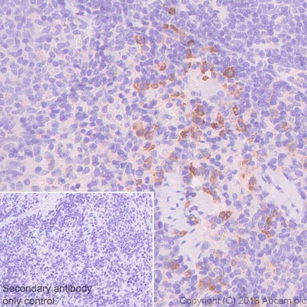 Vpac1 Antibody Sp234 Ab183312  Immunohistochemistry Formalin Pfa Fixed Paraffin Embedded Sections Img100268