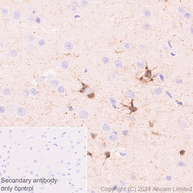 Anti-PADI2 / PAD2 antibody [EPR26940-85](ab322197)