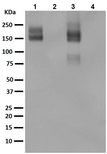 Anti-P Glycoprotein antibody [EPR10364-57](AB170904)