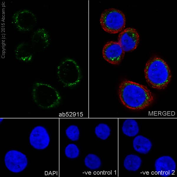 Anti-MMP3 antibody [EP1186Y](AB52915)