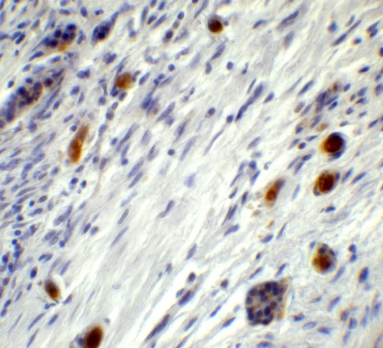 Anti-PGC1 alpha antibody(AB191838)