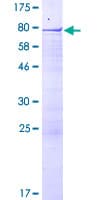Recombinant Human RSBN1/Rosbin protein(AB162810)