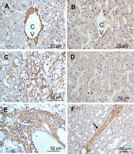 Anti-Collagen III antibody(ab7778)