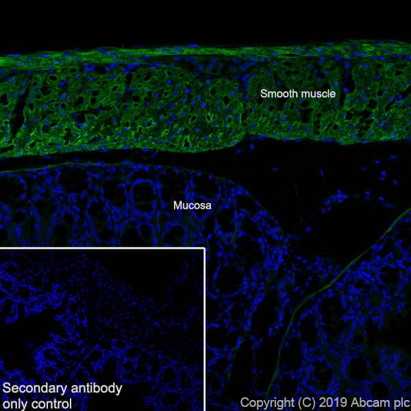 Anti-Fibronectin antibody [EPR23110-46](AB268020)