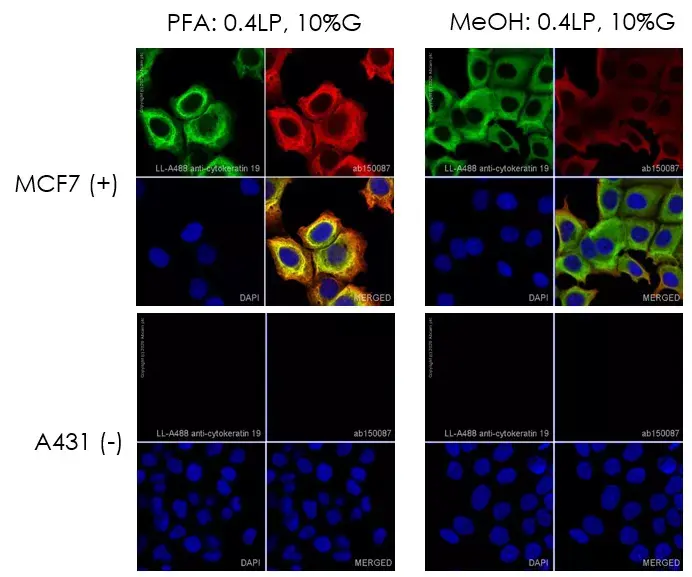 Alexa Fluor® 488 Conjugation Kit (Fast) - Lightning-Link®(AB236553)